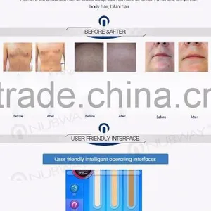 Germany Beauty Laser Equipment Permanent Alexandrite 808nm Diode Laser Body Hair Removal System for Hair Removal thumbnail-6