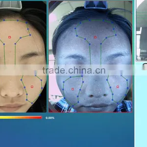 Quantum Analysis Machine/quantum Resonance Magnetic Skin Analyzer Machine thumbnail-2