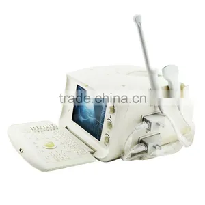 Carejoy Cheapest Portable Ultrasound Machine With Multi Frequency Probe SONY UP-898MD Video Thermal Recorder Optional thumbnail-3