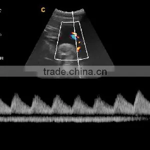 2016 New Portable Color Doppler(Optional 4D) for Cardiac Use thumbnail-4