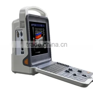 Digital Color Doppler 4D Ultrasound Machine K6 thumbnail-3