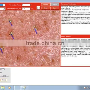 Salon and Home Skin Analyser 3D Facial Skin Analyzer Machine thumbnail-5