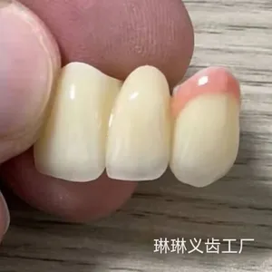 The Telescopic Crown Precision Attachment Denture Has Strong Stability thumbnail-3