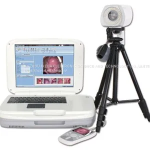 Colposcope Machine Supplier thumbnail-1