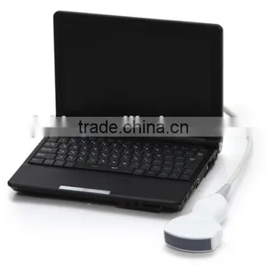 Handheld PC Platform 3D Workstation Ultrasound Scanner With Convex Linear Micro-convex Transvaginal Probe Optional thumbnail-5