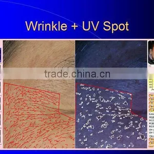 Ultrasonic Cleaner 3d Skin Analyzer thumbnail-2
