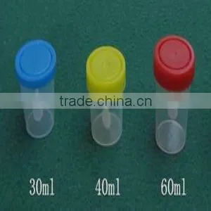 40ml 60ml 80ml 100ml 120ml Urine and Stool Container thumbnail-1