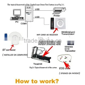 Wireless ECG Stress Test System WiFi With ST Software Kit+Trolley+ Treadmill thumbnail-4