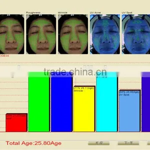 UV Light Skin Scope Face Skin Test Machine thumbnail-4