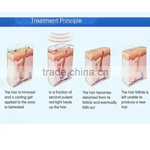 Lip Hair Permanent Hair Removal Laser Hair Removal Machine High Power Skin Rejuvenation 808nm Diode / Diode Laser 808nm 2016 Home thumbnail-5