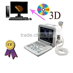 Factory Price!CE Approved Notebook B-Mode Ultrasound Scanner With 7.5Mhz Multi-frequency Rectal Probe RUS-9000B thumbnail-1