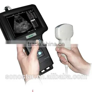 V6 Handle Ultrasound Scanner(ultrasonic,black White,Imaging thumbnail-2