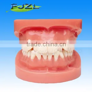 Orthodontic Teeth Model/dental Orthodontic Models thumbnail-1