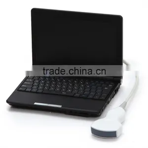 Low Price Full Digital Laptop Ultrasound Scanner RUS-9000F With 3.5Mhz Convex Probe Suitale for Carrying Easy thumbnail-2