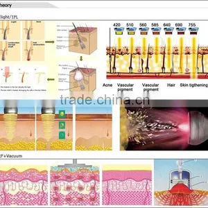 Hot Selling CE TUV 6 Handles Portable Elight Mini Ipl Laser for Age Spots thumbnail-6