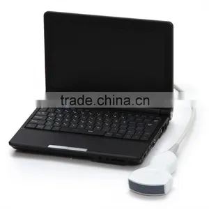 10 Inch Laptop Veterinary / Vet Ultrasound Scanner With 3.5MHz Convex Probe for Equine, Bovine, Swine, Sheep, Cat, Dog thumbnail-2