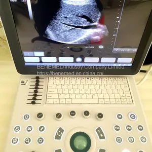 Ultraslim Notebook Type Black and White Ultrasound Scanner Equipment thumbnail-1