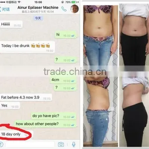 Double Chin Removal Beauty Tighten Cryolipolysis System Fat Freeze Fat Freezing Slimming Cryolipolysis Machine Increasing Muscle Tone thumbnail-5