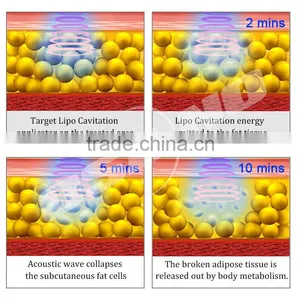 Super Slim Fat Freezing Cryolipolysis Zeltiq Machine With Cavitation Rf Laser Fat Melting thumbnail-6