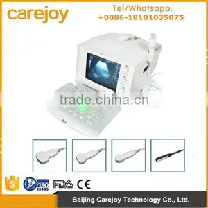 Medical Equipment Ultrasound Scanner Portable 10 Inch Optional Different Probe Manufacture thumbnail-1