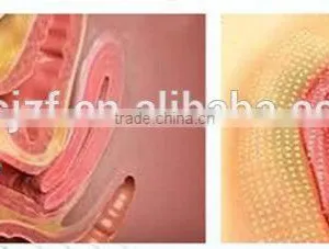 Popular Model F7+ Beauty Device Fractional Co2 Laser Vaginal Tightening thumbnail-6