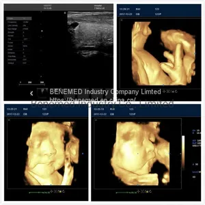 4D Color Doppler Ultrasound Scanner With Touch Screen thumbnail-5