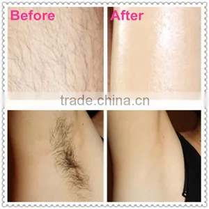 Professional Shr Ipl Hair Removal Machine thumbnail-5