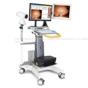 Infrared Mammary Gland Examination System thumbnail-1