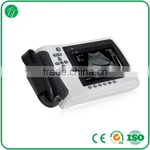 Cheap Chinese Convex Ultrasound Scanning Diagnostic Equipment 3018H thumbnail-2