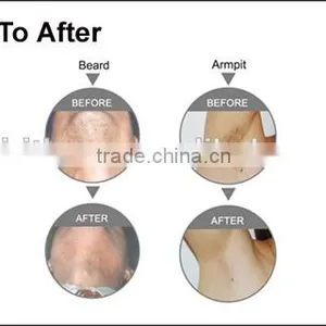 2016 Medical CE Approved Ipl, Ipl Home Laser Pigmentation, Home Ipl thumbnail-2