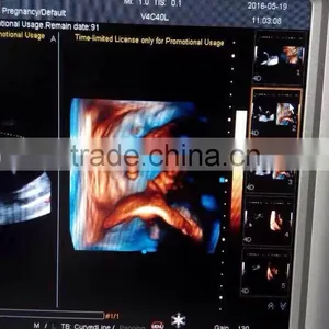 New Laptop/Portable Color Doppler 3D/4D Ultrasound Diagnostic System Machine Q9 thumbnail-3