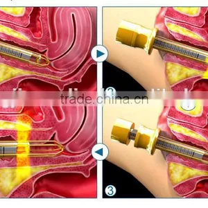 0.1mj-300mj Facial Skin Lifting And Tightening Fractional Co2 Laser/vaginal Tightening Co2 Laser Machine Eye Wrinkle / Bag Removal thumbnail-5