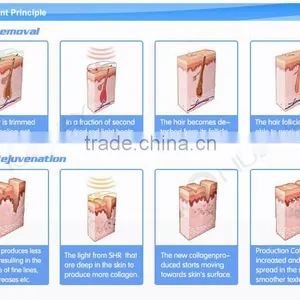 Skin Guardian!! IPL Laser Hair Removal / IPL Skin Rejuvenation Machine Price / IPL Machine Price With CE thumbnail-5