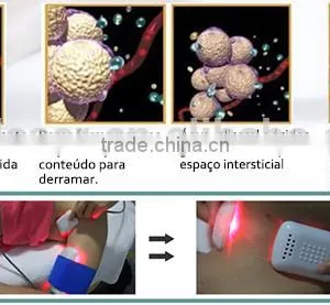 SUS Portable Lipo Diode Laser Slimming Diode Laser Medical Laser Sliming thumbnail-2