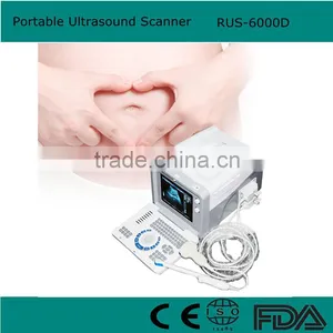 10 Inch Ultrasound Scanner Portable Ultrasonic Diagnostic Machine With 3.5MHz Convex Probe Good Price thumbnail-1