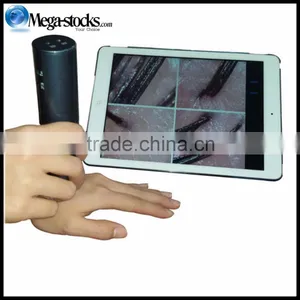 2MP 600X HD Scalp Detector, Hair Detector, Skin Detector, Wireless WiFi Connection Phone Tablet Hair Analyzer thumbnail-3