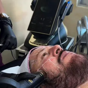 All-in-One Facial Machine: 25D HIFU, RF, and EMS for Professional Skin Rejuvenation thumbnail-1