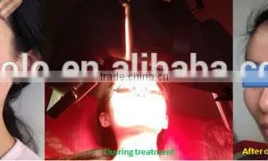 Facial Led Light Therapy High Power Acne Removal Phototherapy PDT Machine Led Light For Skin Care thumbnail-3