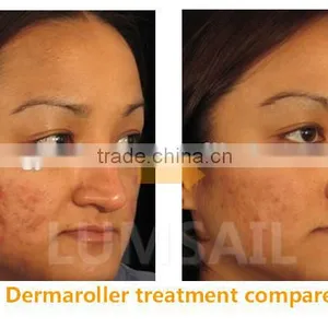 Dermaroller Derma Roller Medical Derma Roller Micro Needle Dermaroller for Salon Use thumbnail-6