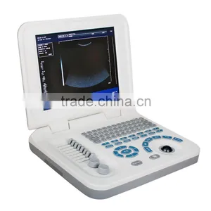 RUS-9000F2 CE Approved Hot Selling Digital Handheld Ultrasound Machine Medical Equipment-Shelly thumbnail-3