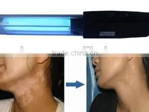 2015 Derma 1 Series 311nm Lamps,UVB Therapy Lamp--- Vitiligo thumbnail-2