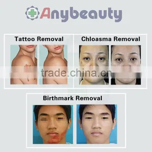 Carbon Peeling Treatment/tatoo Removal Machine Carbon Peeling Treatment thumbnail-3