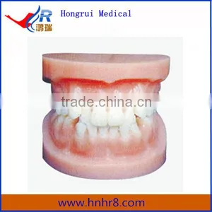 Dental Orthodontic Model for Teaching thumbnail-1