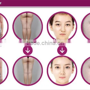 2016 New Type Body Shape Machine With CE thumbnail-6