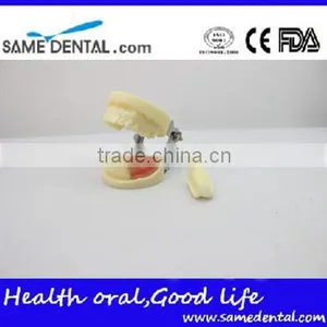 Dental Implant Practice Model DEA-31 Teeth Implant Models thumbnail-2