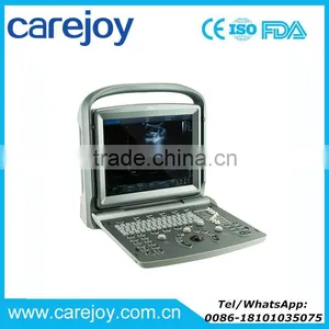 12 Inch LED Portable 3D/4D Color Doppler Ultrasound System by CE/ISO Certified thumbnail-1
