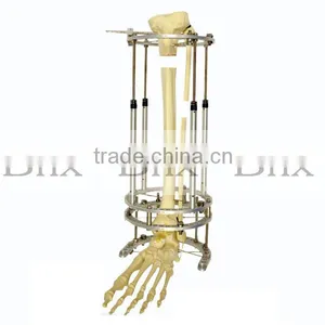 Circular Fixator in Orthofix Shape thumbnail-2