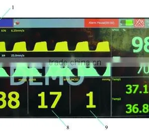 Vet Surgical Patient Monitor thumbnail-3