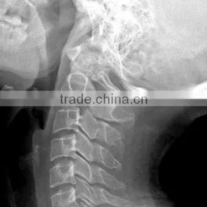 Medical Dry Films,medical Films.fuji Dry Film thumbnail-4