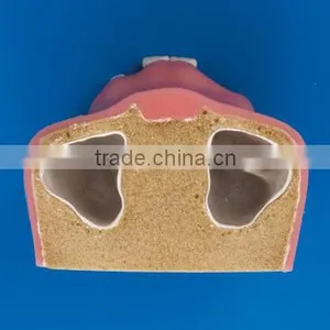 Factory Price Clinical Drill Model Cableway/ Dental Implant Model/implantes for Teeth thumbnail-4